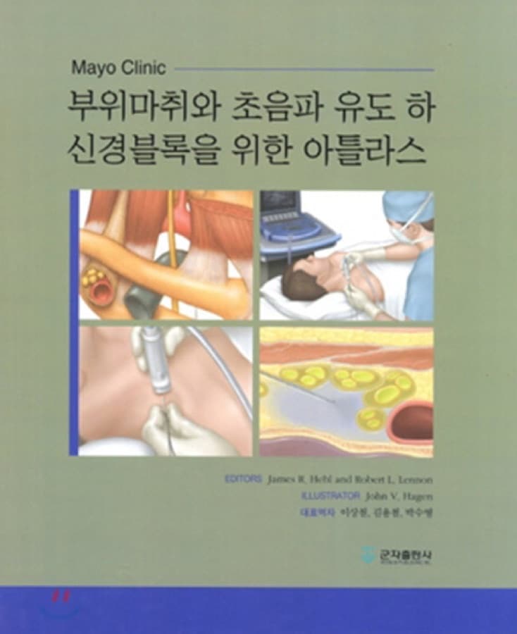 부위마취와 초음파 유도 하 신경블록을 위한 아틀라스 표지