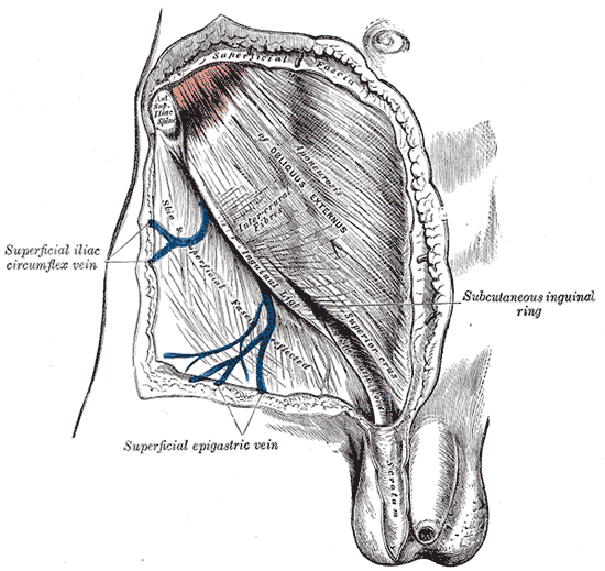 아랫배와 사타구니의 표층 그림 - 아랫배를 덮은 외복사근 널힘줄(Aponeurosis of Obliquus externus)이 아래쪽에서 서혜인대(Inguinal lig.)로 이어지고, 그 안쪽 끝 치골 가까이에 표재 서혜륜(Subcutaneous inguinal ring)이 벌어져 있으며, 위쪽 모서리(Superior crus)와 섬유 다발(Intercrural fibres)이 보인다