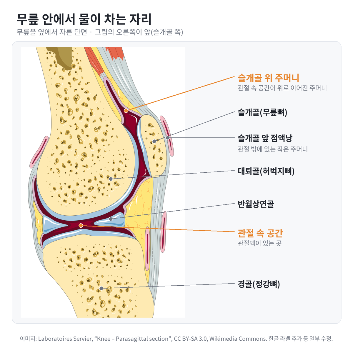 무릎을 옆에서 자른 단면도. 대퇴골, 슬개골, 경골, 반월상연골과 함께 물이 고이는 관절 속 공간과 슬개골 위 주머니가 표시되어 있다