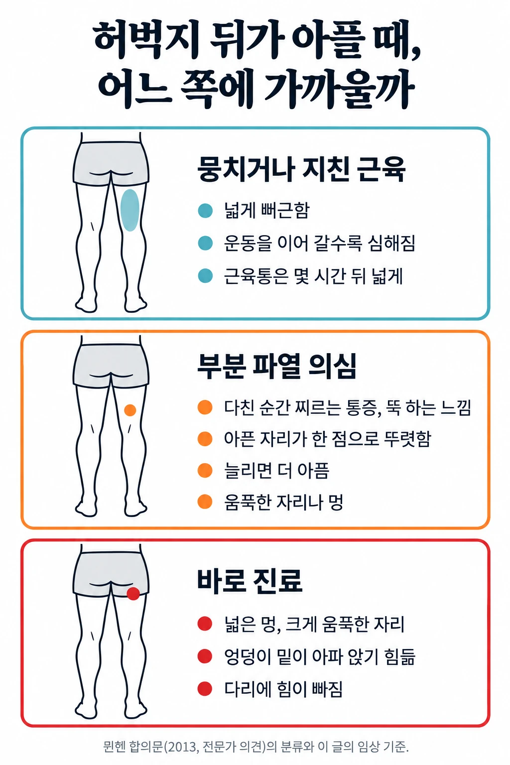 허벅지 뒤 통증을 세 칸으로 나눈 그림. 첫 칸 뭉치거나 지친 근육은 넓게 뻐근하고 운동을 이어 갈수록 심해지며, 지연성 근육통은 몇 시간 뒤 넓게 온다. 둘째 칸 부분 파열은 다친 순간 찌르는 통증이나 뚝 하는 느낌이 있고, 아픈 자리가 한 점으로 뚜렷하며, 늘리면 더 아프고, 움푹한 자리나 멍이 있을 수 있다. 셋째 칸 힘줄이 떨어진 손상이 의심되면 넓은 멍, 크게 움푹한 자리, 엉덩이 밑이 아파 앉기 힘듦, 다리에 힘이 빠짐이 있고 바로 진료를 받는다.