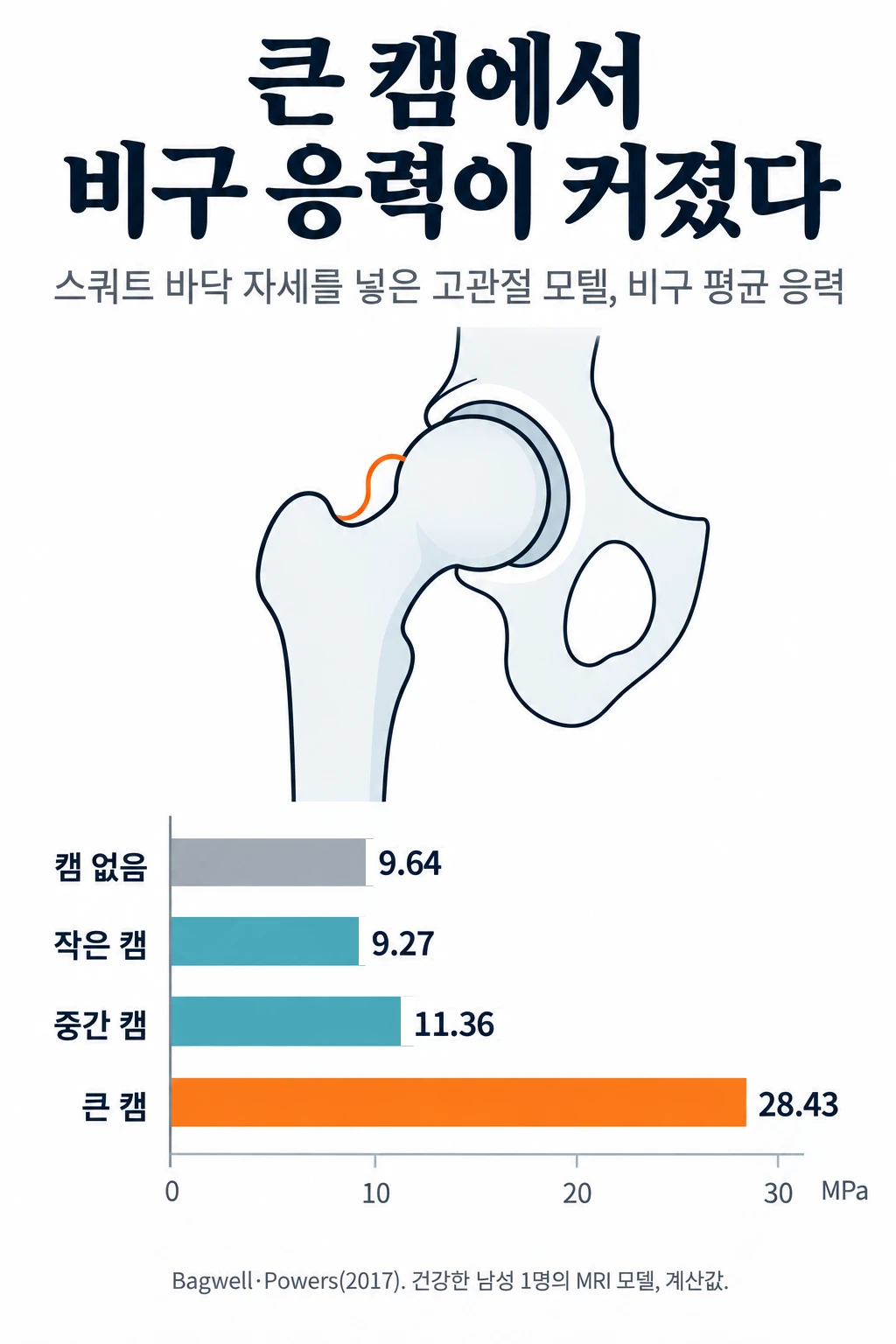 고관절을 앞에서 본 단순한 선 그림과 비구 평균 응력 막대그래프. 캠이 없는 모델 9.64 MPa, 작은 캠 9.27 MPa, 중간 캠 11.36 MPa, 큰 캠 28.43 MPa. 작은 캠까지는 캠이 없는 모델과 비슷했고, 큰 캠에서 크게 늘었습니다.
