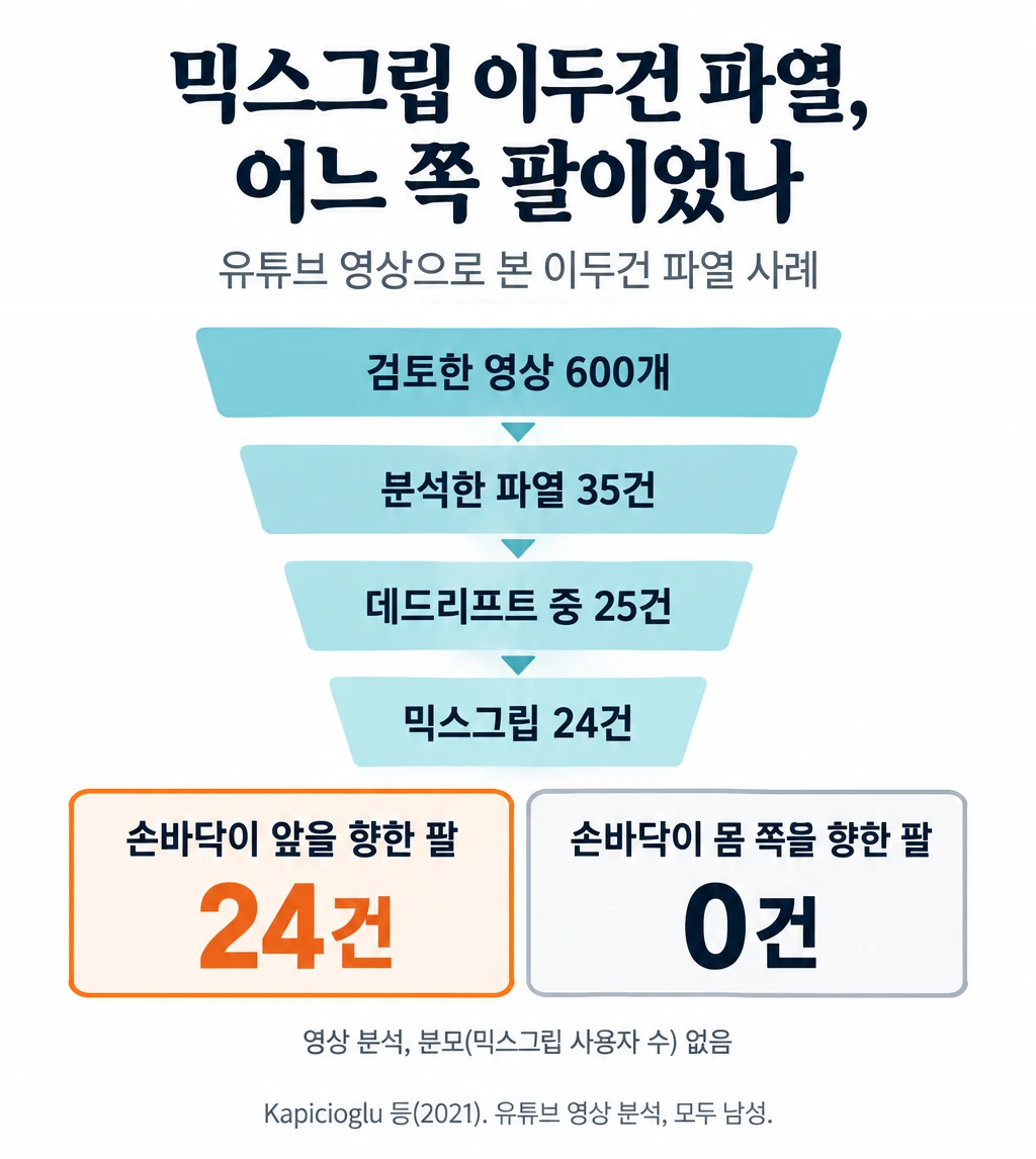믹스그립으로 바벨을 잡은 두 손의 선 그림과 영상 분석의 단계별 건수. 이두건 파열 영상 600개를 검토해 35건을 분석했고, 그중 25건이 데드리프트, 24건이 믹스그립이었으며, 24건 모두 손바닥이 앞을 향한 쪽 팔에서 파열이 일어났고 손바닥이 몸 쪽을 향한 팔에서는 0건이었다.
