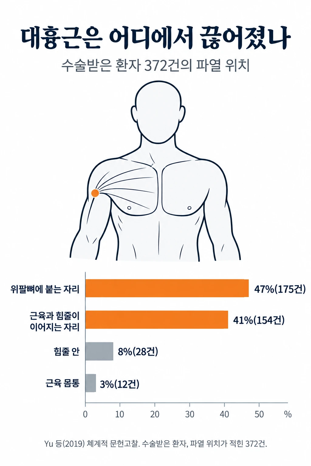 대흉근 파열이 어디에서 일어났는지 비교한 가로 막대그래프. 수술받은 환자 372건 가운데 위팔뼈에 붙는 자리 175건(47%), 근육과 힘줄이 이어지는 자리 154건(41%), 힘줄 안 28건(8%), 근육 몸통 12건(3%).
